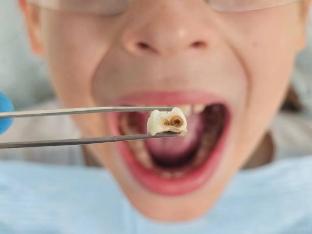 Best Urgent Care for Lost Fillings or Crowns in Waldron, AR